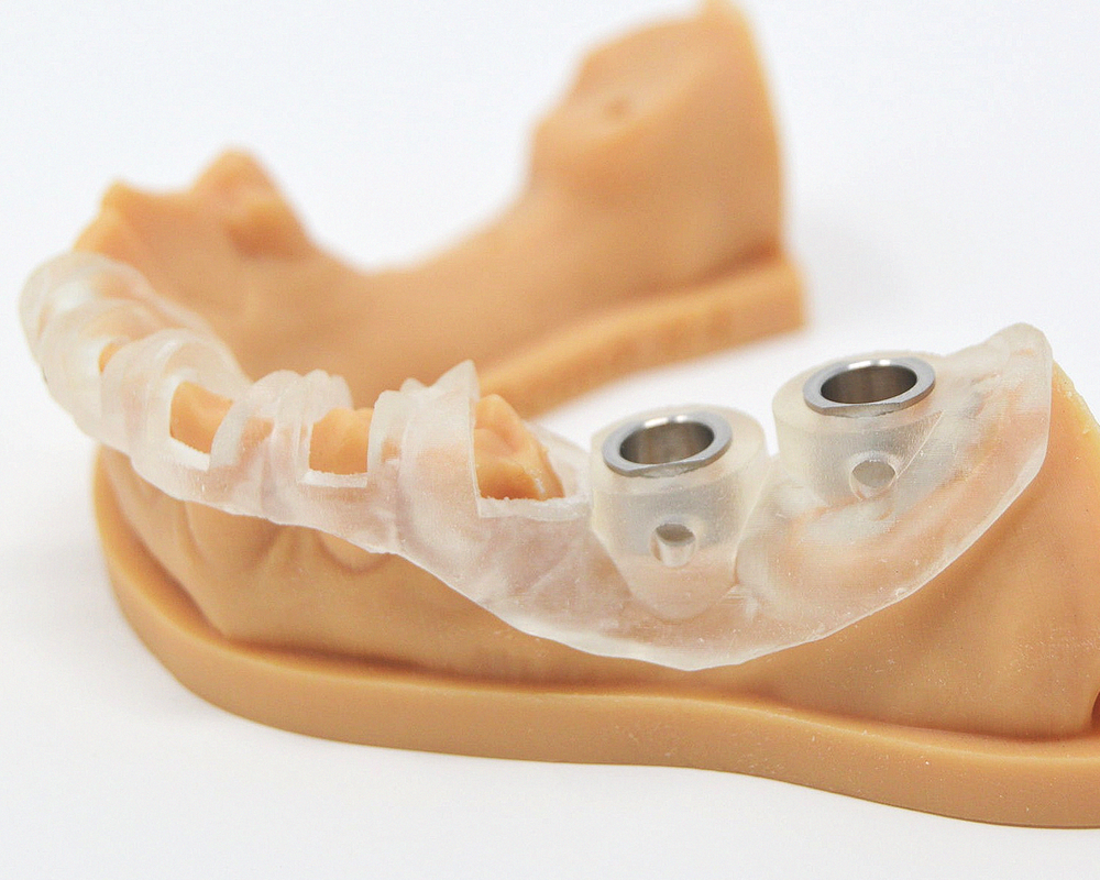 хирургический шаблон