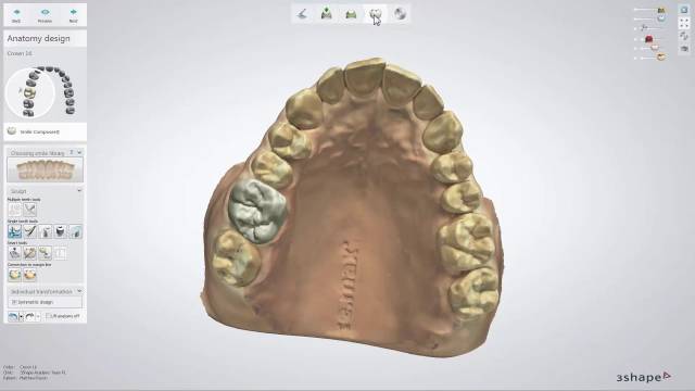 3Shape Dental System: Обзор и применение