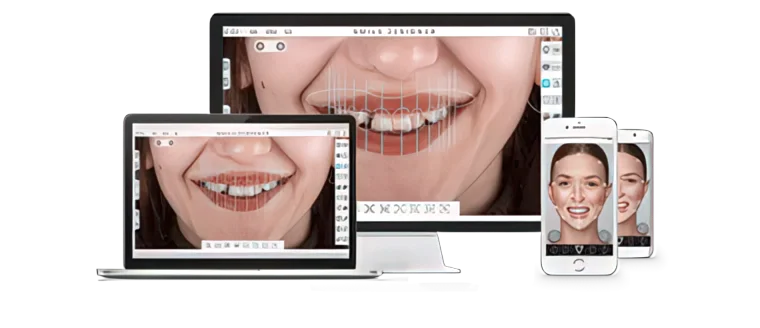 Дизайн улыбки