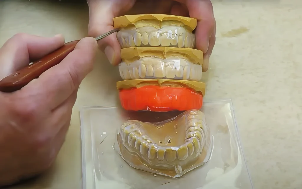 Изготовление защитной каппы