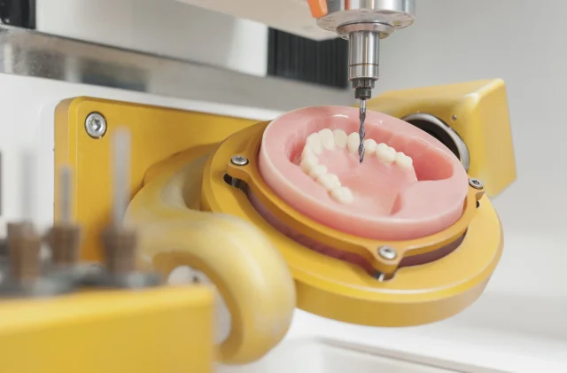 CAD/CAM: шаг в будущее стоматологии