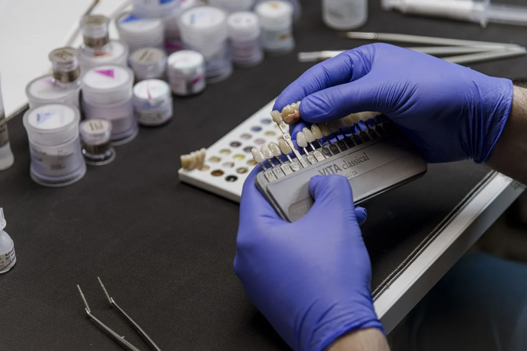 подбора оттенка зубной коронки по шкале VITA Classical